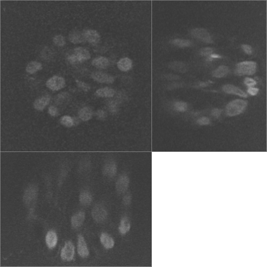 Fig. 1: Two photon imaging of a MCF10A spheroid. MCF10A immortalized mammary epithelial cells were infected with a pBabe-GFP-H2B retroviral construct and grown in 3D culture conditions. Images were acquired using a Leica TCS SP5 confocal microscope couple
