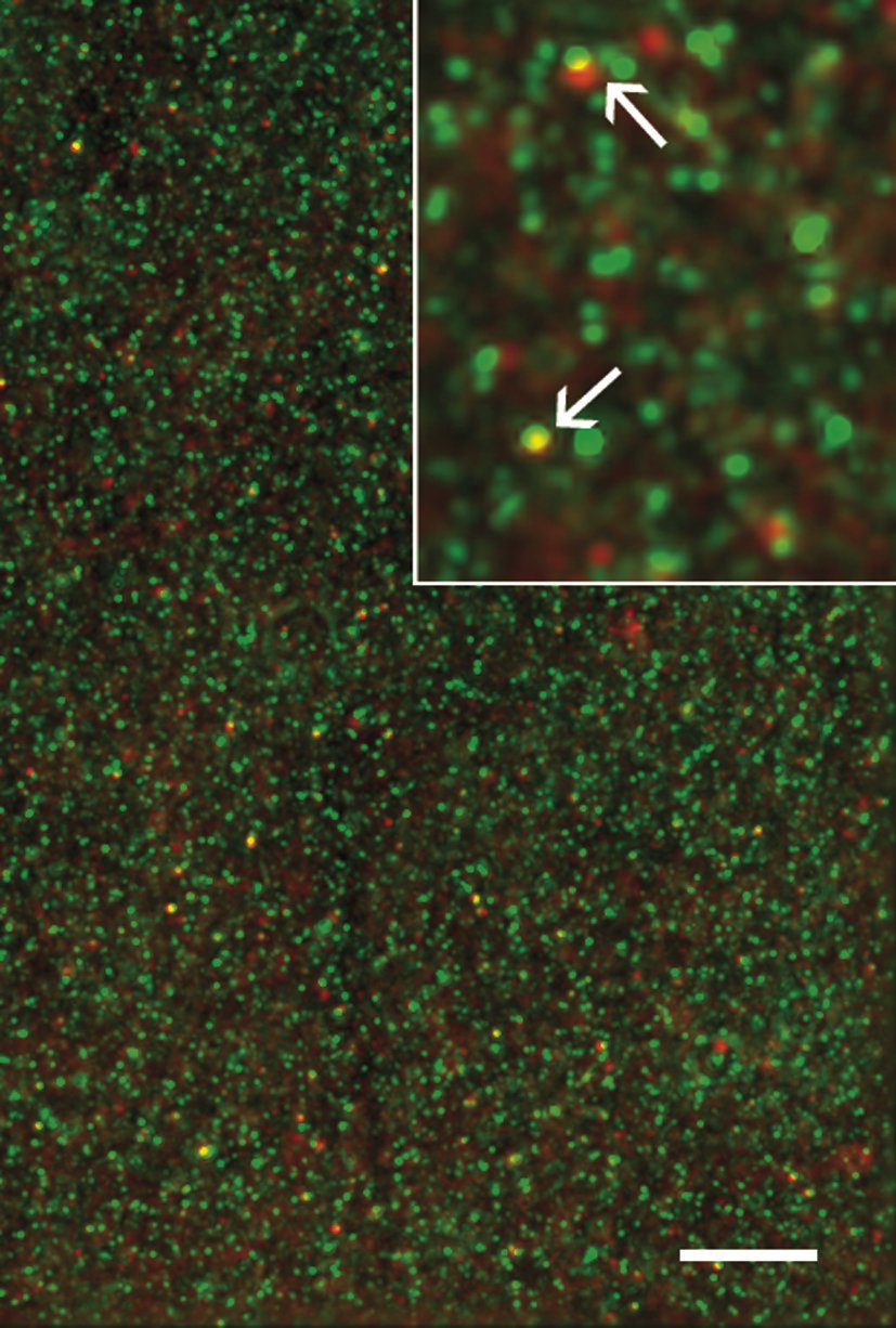 Fig. 1: A hippocampal brain slice was labeled with anti-PSD95 (green) and anti-phospho-p21-activated kinase (p-PAK; red). Low power image shows typical labeling in field CA1 stratum radiatum where quantitative analysis is performed. High magnification ins