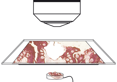 Step 3: Dissectate is collected by gravity Step 3: Dissectate is collected by gravity
