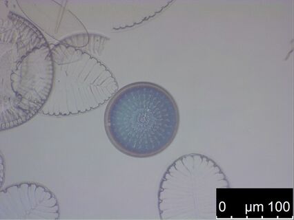 Fixed maritime diatoms on a glass slide.