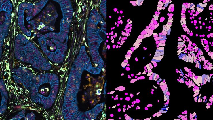 48 channel human colon channel image acquired on Leica Cell DIVE system
