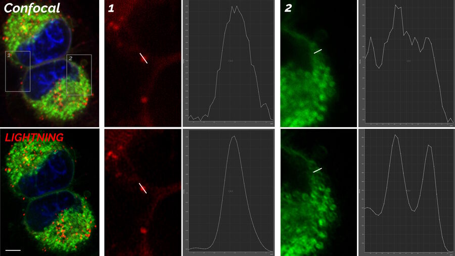 Projection of a confocal z-stack without and with LIGHTNING applied