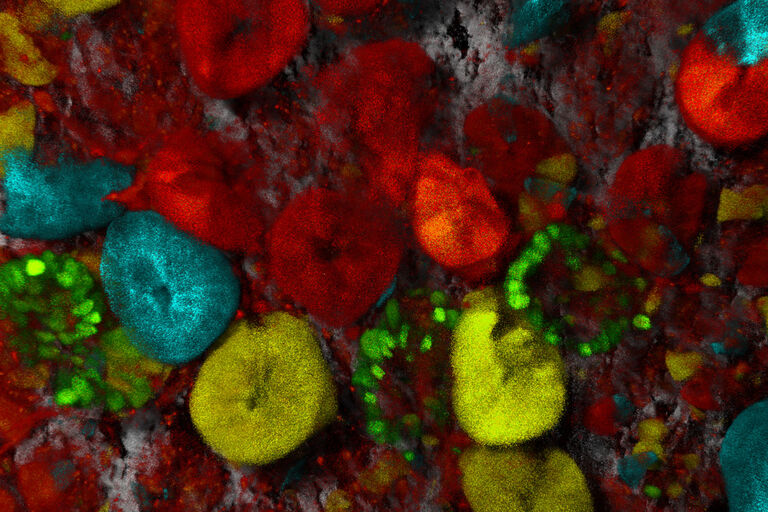 Confetti mouse small intestines: Collagen1 is shown in gray (label free SHG) and lineage traced stem cells are shown in cyan, green, yellow, and red. Stem cells play an important role in the spread of cancer within organisms. Sample courtesy of Jacco van Rheenen, Netherlands Cancer Institute, NL.