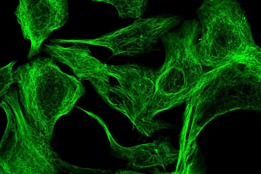 Methanol fixed MDA-MB-468 cells where tubulin-antibody staining was done for mouse IgG anti beta tubulin (primary) and donkey IgG-fab2-fragment anti-mouse was labeled with ATTO 488 (secondary).
