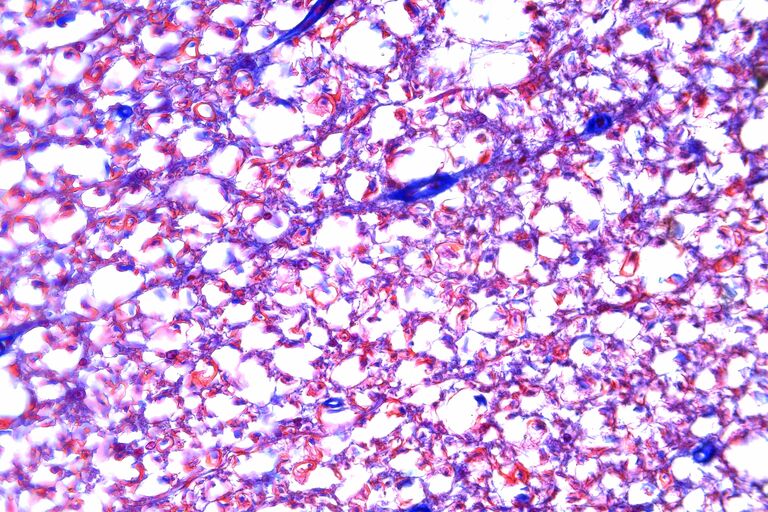 Imagem colorida de uma amostra histopatológica, seção da medula espinhal, tirada com uma lente objetiva de 40x.