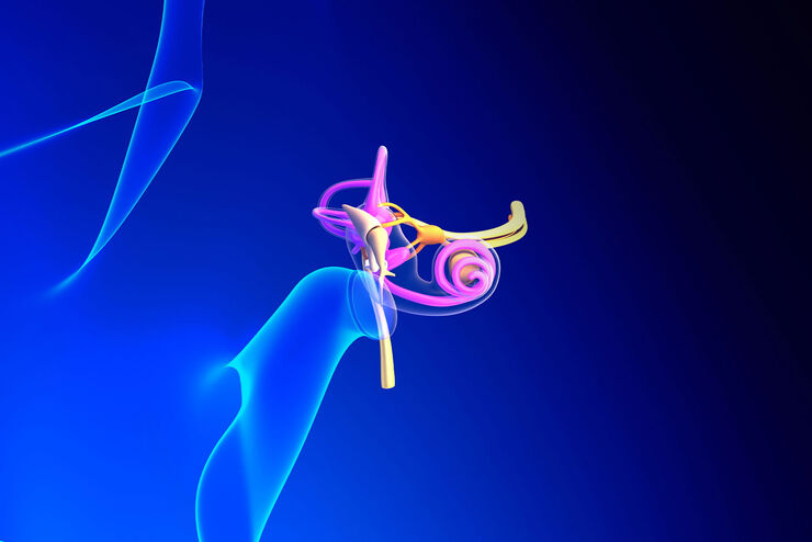 Superior Semicircular Canal Dehiscence (SSCD) or Minor’s syndrome