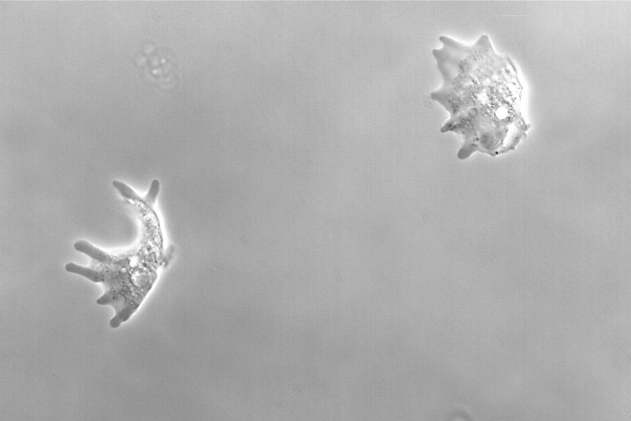 Phase Contrast Amoeba Proteus, phase contrast microscope