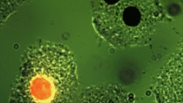 Fluorescence microscopy image of liver tissue where DNA in the nuclei are stained with Feulgen-pararosanilin and visualized with transmitted green light.