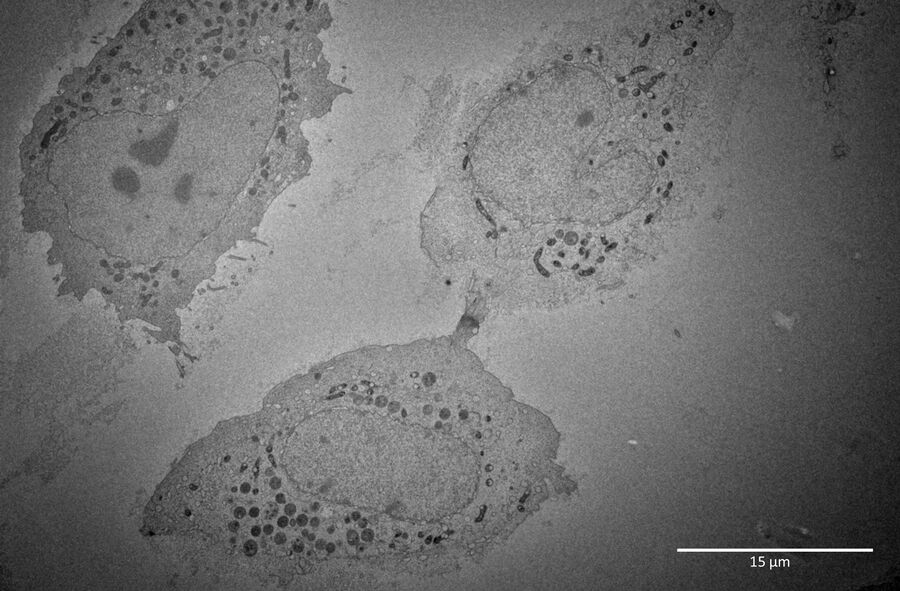 TEM image of the dividing HeLa cells, still connected by the intercellular bridge.