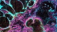 Co-detection of 10 extracellular matrix proteins and 3 topographical tissue landmarks by multiplex immunostaining within a single high-grade fibrous hotspot from a human hepatocellular carcinoma