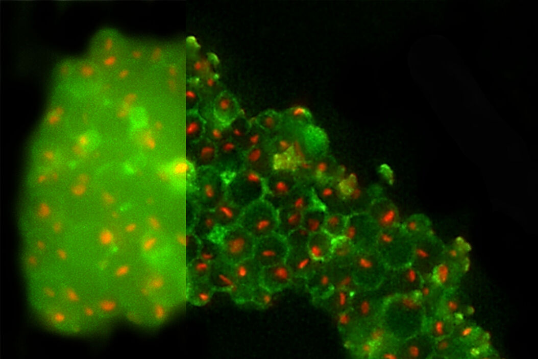  Yeast_Nucleoli_bf_and_aft_THUNDER.jpg