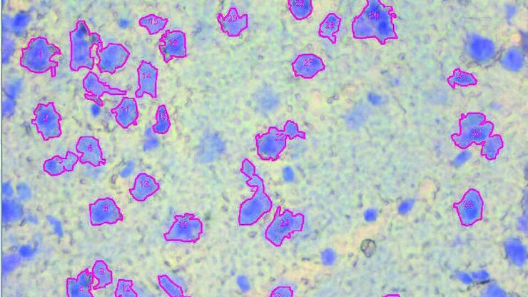 Brain section 12 μm, before dissection, objective 63x, stained with Toluidin blue.