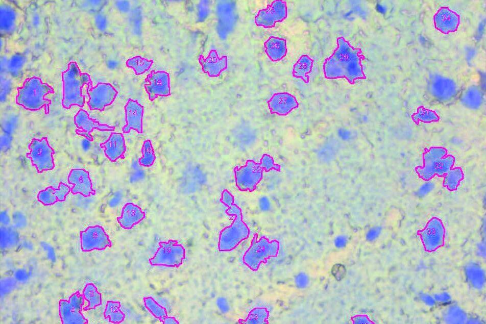 Brain section 12 μm, before dissection, objective 63x, stained with Toluidin blue. AVC_02.jpg