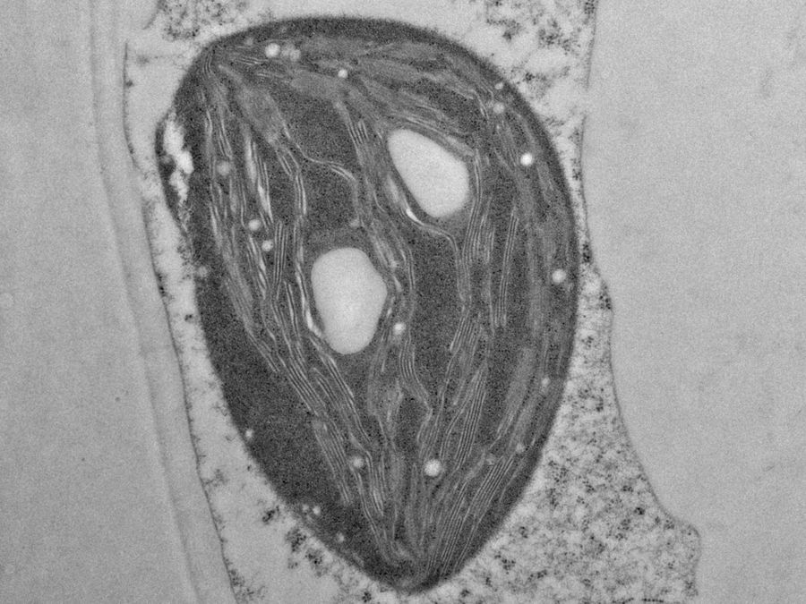 EM image of a specimen of an Arabidopsis leaf, infected with a parasitic Albugo oomycete, a fungus-like microorganism. The image was taken after HPF preparation. Additionally, actin in the leaf is expressing green fluorescent protein (GFP). Courtesy of K. Findlay, John Innes Centre, Norwich, UK.