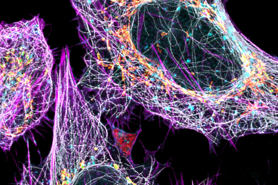 Maximum projection of 5 color U2OS fixed cells