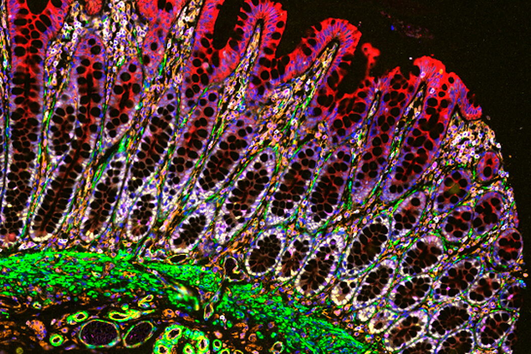 Normal colon imaged with Cell DIVE. 8 biomarkers are shown: CD20, CD4, CD31, SOX9, Vimentin, Ki67, Panck and SMA. Normal_colon_imaged_with_Cell_DIVE.jpg