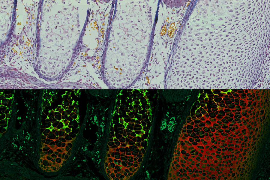 Mouse embryo labelled with Heidenhain azan trichrome stain