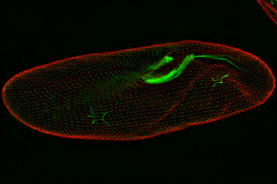 Paramecium - THUNDER Imager