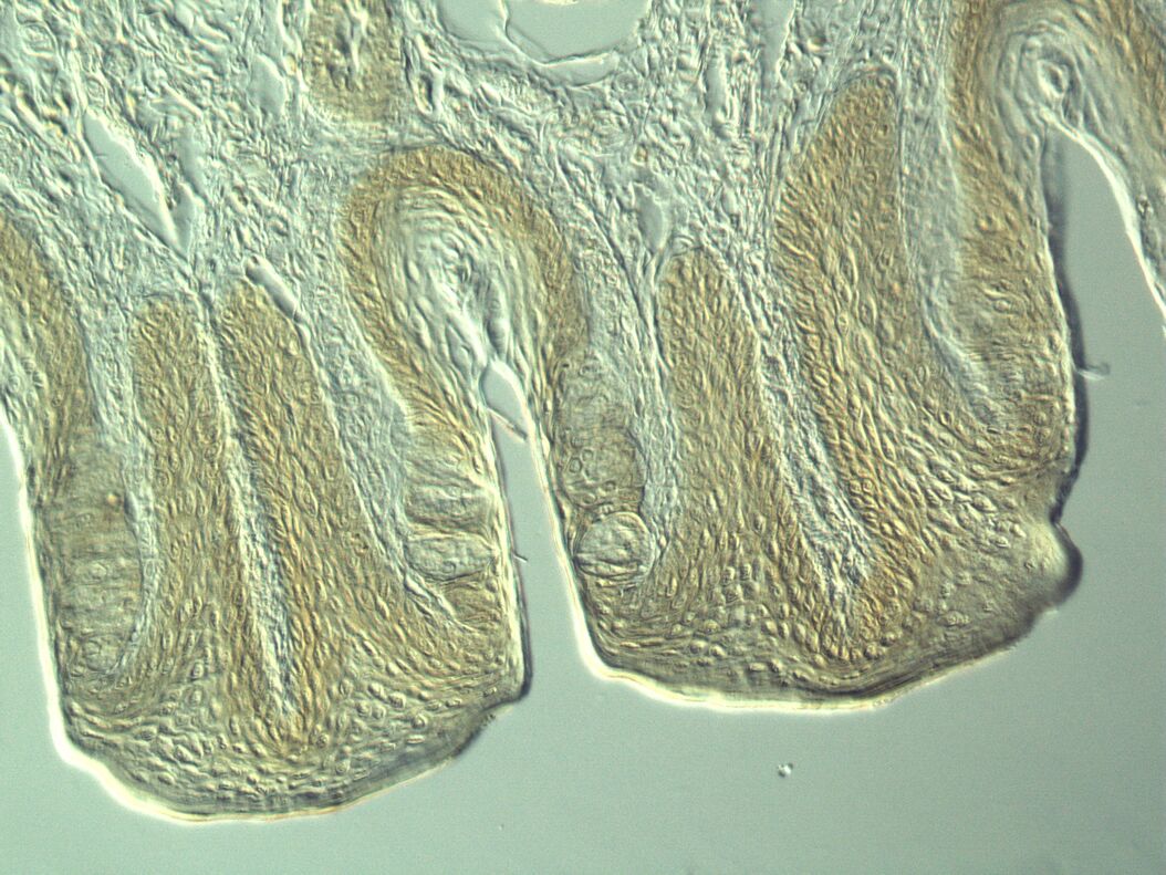 Section taste buds rabbit, differential interference contrast microscope Section_taste_buds_rabbit_DIC_microscope.jpg