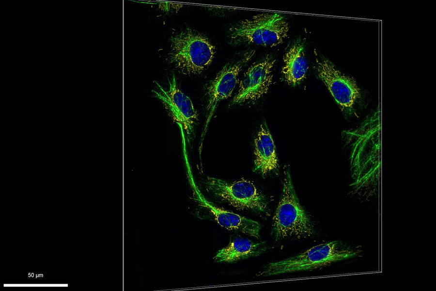 Cultured VERO cells stained with STAR488 Vimentin (green), STAR580 Tom20 (yellow), and DAPI (blue). Sample courtesy of Abberior GmbH, Göttingen, Germany.