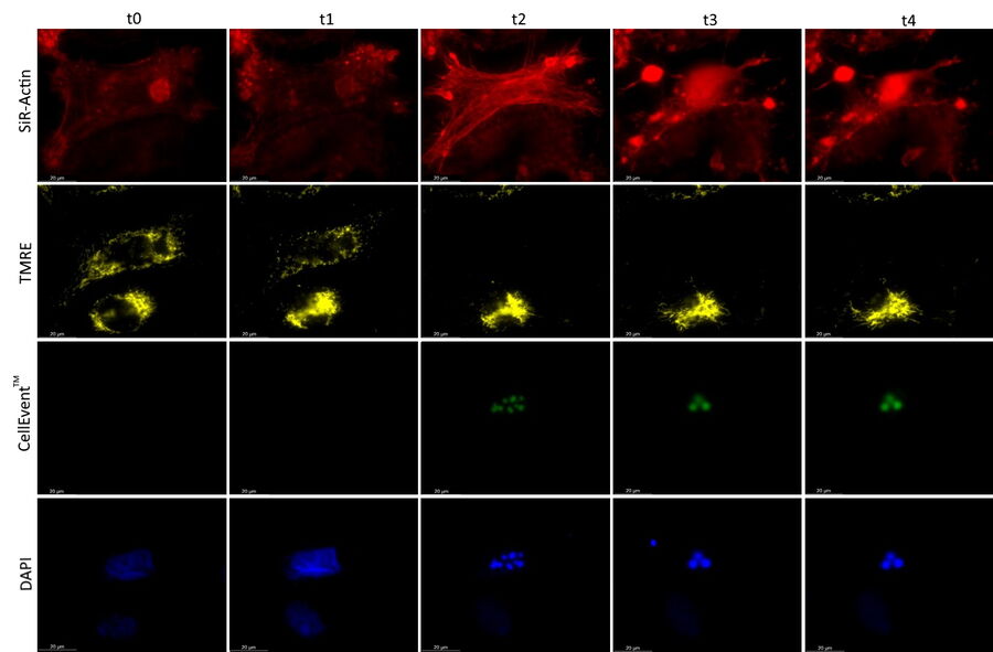 Time lapse images of U2OS cells; 13-hour time-lapse acquisition: 