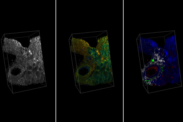 腎臓切片をRapidClearで透明化処理して多光子励起でイメージング。 最初の画像は蛍光輝度、2番目はTauContrast（850 nm励起）、3番目は4つのスペクトルチャネルからの画像であり、赤色は血管（AF488、920 nm励起）、灰色はコラーゲン（SHG）、緑色は神経細胞（SytoxOrange、1040 nm励起）および青色は核（AF633、1100 nm励起）を示す。 提供： SunJin Labs。