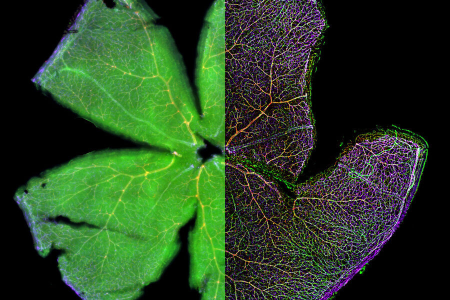 Mouse retina was fixed and stained by following reagents: anti-CD31 antibody (green): Endothelia cells, IsoB4 (red): Blood vessels, and microglia anti-GFAP antibody (blue): Astrocytes Sample courtesy by Jeremy Burton, PhD and Jiyeon Lee, PhD, Genentech Inc., South San Francisco, USA. Imaged by Olga Davydenko, PhD (Leica).