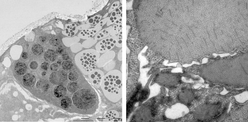 Gland cell granules in the clitellum region of Tubifex sp. (left) and Longitudinal muscles of Tubifex sp. (right).