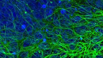 Human iPSC derived mid brain organoid. Stained with MAP2 (green) and DAPI (blue). Image acquired using THUNDER Imager Cell Spinning Disk; scale bar 50 µm. Courtesy of Dr Tanya Singh (Salman and Wade-Martins Lab), Department of Physiology, Anatomy and Genetics, University of Oxford.