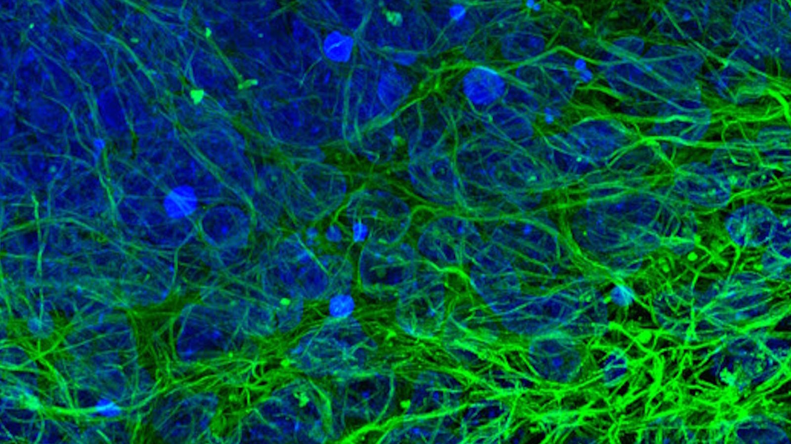 Human iPSC-derived mid brain organoid. Image acquired using THUNDER Imager Cell Spinning Disk. Courtesy of Dr Tanya Singh (Salman and Wade-Martins Lab), Department of Physiology, Anatomy and Genetics, University of Oxford.