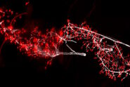 Links: Nicht-prozessiertes Weitfeld-Bild. Rechts: THUNDER Bild nach ICC der neuromuskulären Verbindungen im Gewebe der Maus. Neurofilamente sind weiß und das Alpha-Bungarotoxin sind rot dargestellt. Bilder mit freundlicher Genehmigung von Dr. Andrea Yung aus dem Labor von Dr. Mark Krasnow in Kalifornien, USA.
