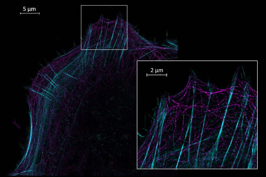 Figure 1: Multicolor TauSTED Xtend imaging with 589 nm STED laser using 2 standard fluorophores. CF440-Phalloidin (Actin, cyan) and StarGreen-tubulin (magenta). 