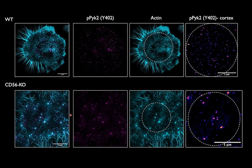 Novel_regulators_of_actin_cytoskeletal__teaser.jpg