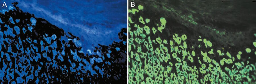Tissue cells immunolabeled with FITC and illuminated with wide-band UV excitation (A) and epi-illumination using narrow-band blue (490 nm) light (B).