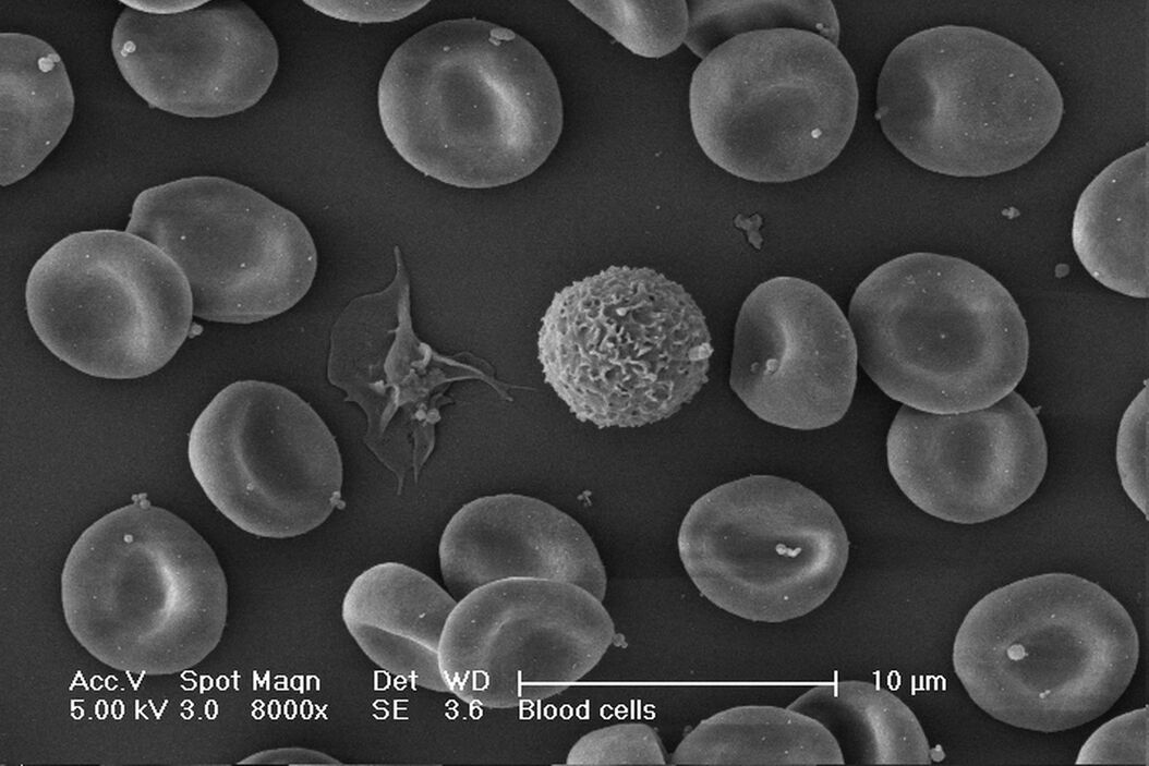 Blood cells. Critical Point Drying. Critical_Point_Drying_03.jpg