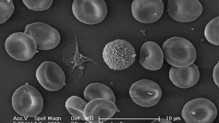 Blood cells. Critical Point Drying. Blood cells. Critical Point Drying.
