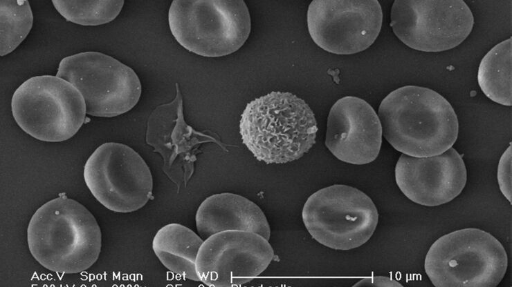 Blood cells. Critical Point Drying.