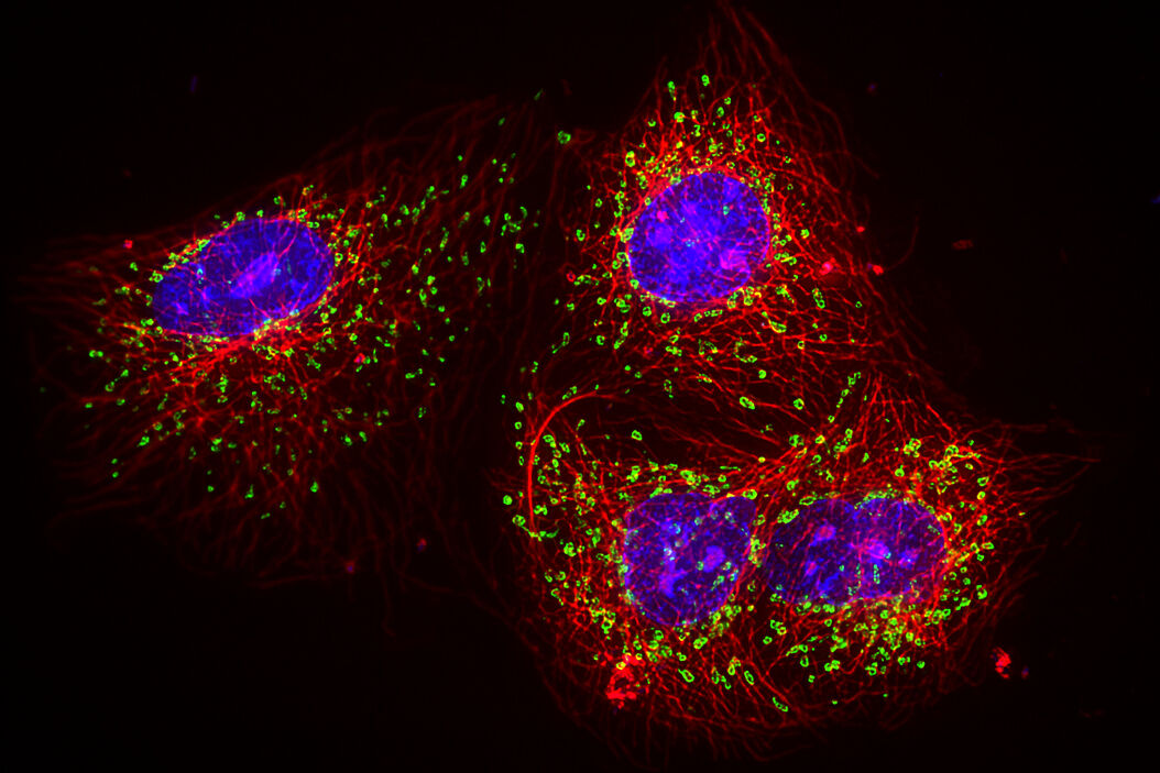  Unmixing_multicolour_widefield_fluorescence_images_teaser.jpg