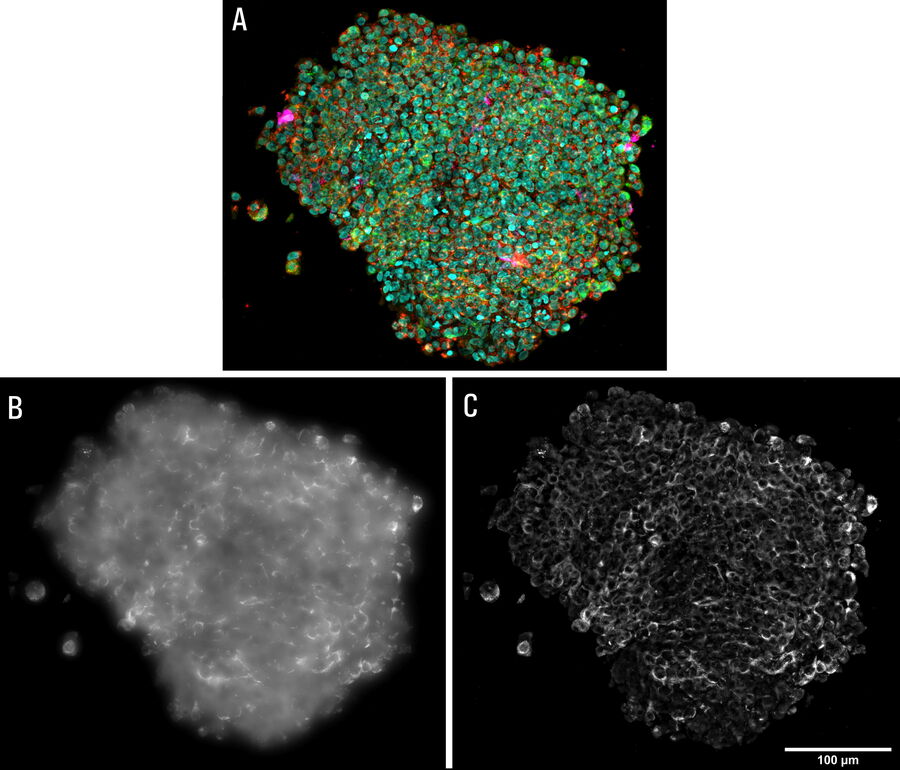 EDoF reconstruction images of a whole human pancreas isle