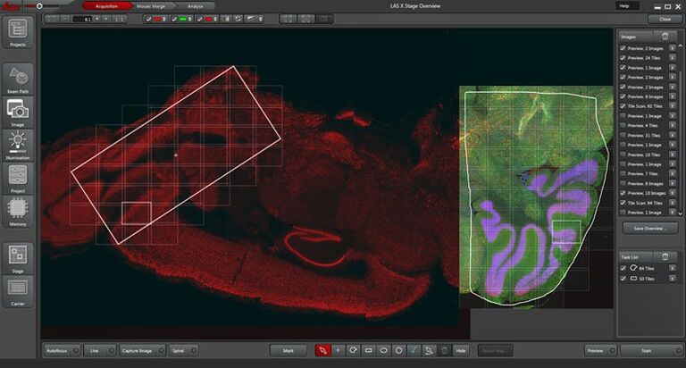 3색 면역 형광 염색된 마우스 뇌 섹션의 Overview 스캔과 고해상도 타일 스캔을 위해 선택된 2개의 관심 영역. 중국 Xiamen 대학교 생명과학부, Wie Mo 박사 제공.