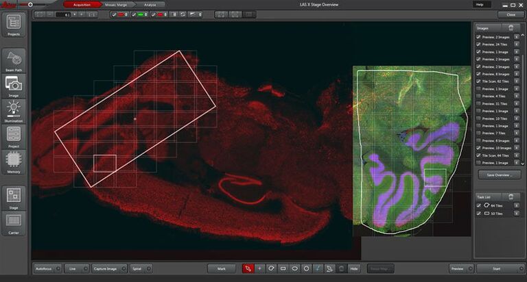 Overview scan of a three-color immunofluorescently stained mouse brain section with two regions of interest selected for higher resolution tile scans. Courtesy of Dr. Wei Mo, School of Life Sciences, Xiamen University, China. 