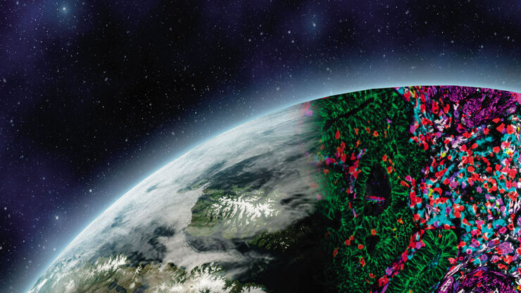 How is microscopy used in spatial biology? A microscopy guide. How is microscopy used in spatial biology - Teaserimage
