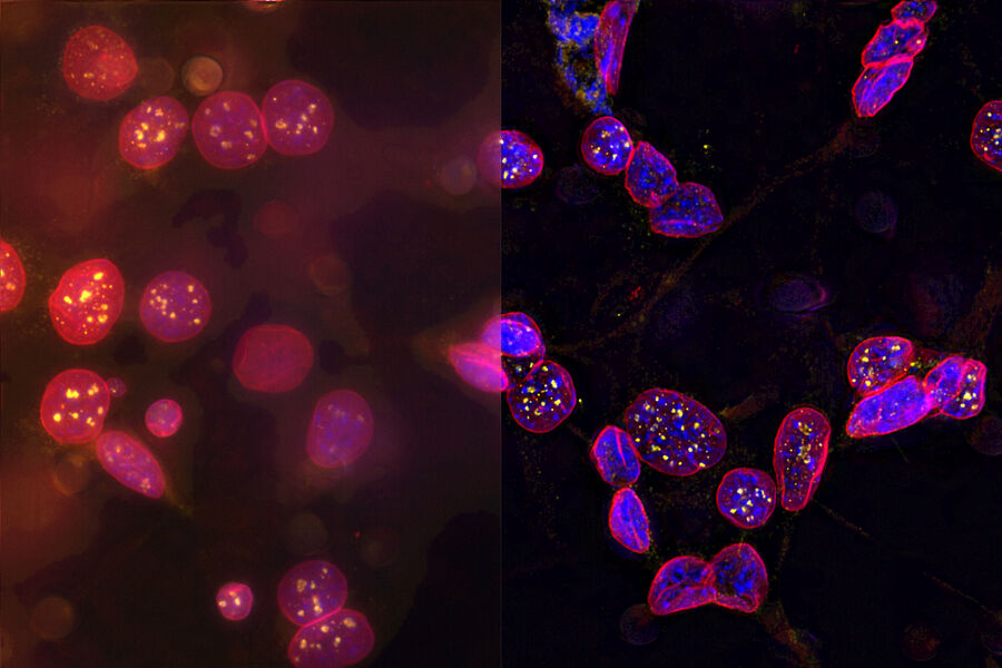 C2C12 cells - THUNDER Imager 3D Live Cell & 3D Cell Culture