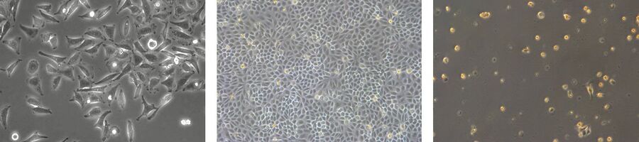 Células semelhantes a fibroblastos, células epiteliais e células semelhantes a linfoblastos (da esquerda para a direita).