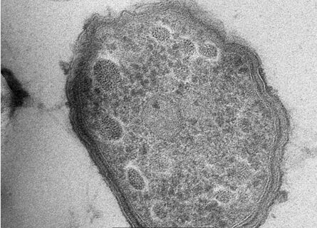 Acidithiobacillus sp. HV2/2.