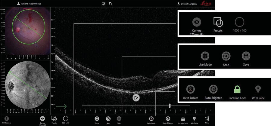 [Translate to chinese:] Figure 22: Intuitive user interface for selection of scan patterns, image acquistion, and image optimization functions.