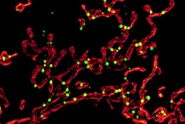 Dual color volume rendering of Drp1 oligomers (green) and mito OM (red) in a live U2OS cell