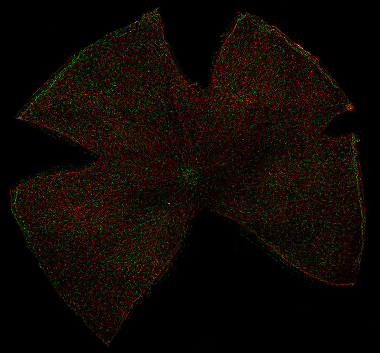 Retina control de hembra adulta de ratón Swiss mostrando células microgliales Iba1+ (Alexa Fluor® 488 fluorocromo verde) y células ganglionares retinianas Brn3a+ (Alexa Fluor® 594 fluorocromo rojo). Imagen cortesía del grupo de Oftalmología Experimental, Universidad de Murcia (España).