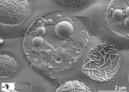 Advance Cryogenic Sample preparation techiniues for electron microscopy