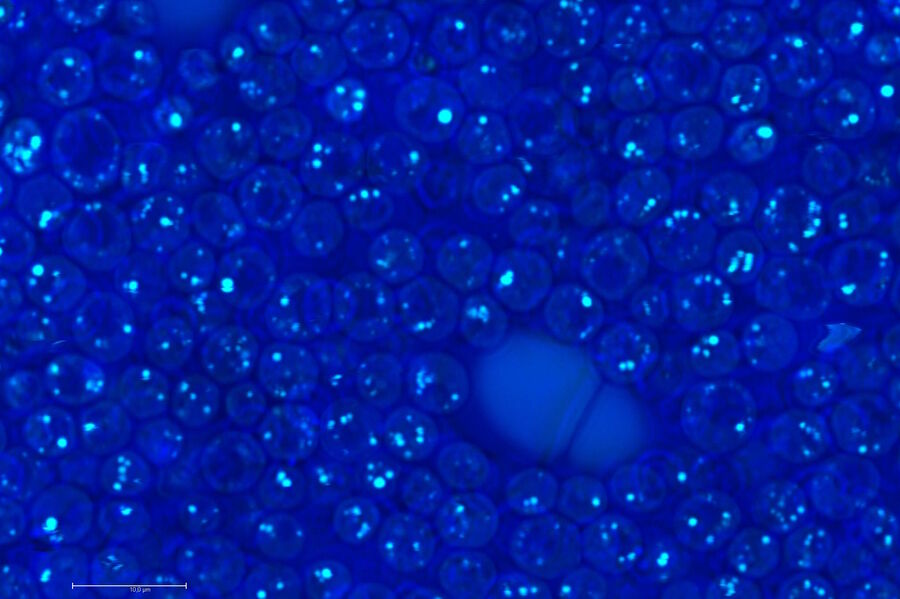 In vivo imaging of yeast cells. The images have been taken at two different wave numbers.